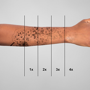 Riviera medical center laser hair removal Clearance